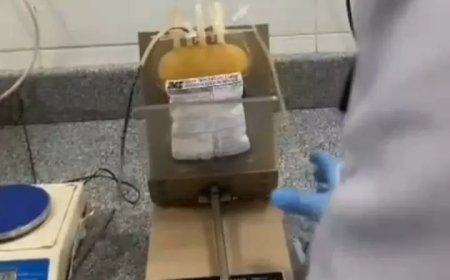 توفير مشتقات الدم بمستشفى الفشن المركزي لخدمة مرضي التليف الكبدي والغسيل الكلوي