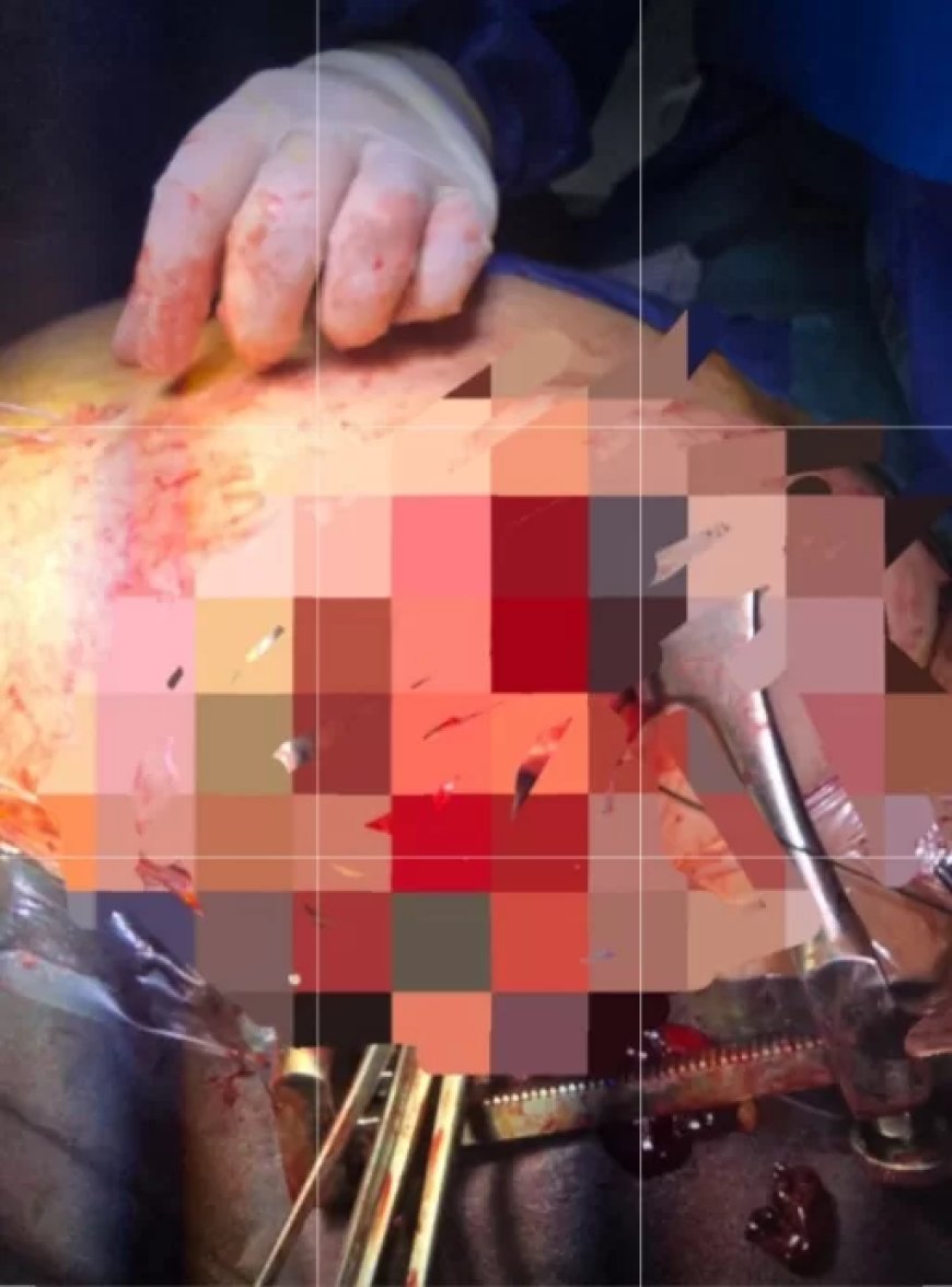 أطباء سوهاج الجامعي ينقذون شابًا من موت محقق بعد إصابته بطعنة قاتلة في القلب والرئة