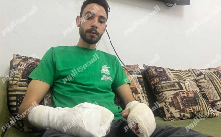 «مش قادر أعيش».. ضحية جريمة البلاي ستيشن يروي الاعتداء بسبب الخلاف على الأسعار (فيديو)