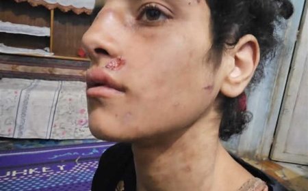 حالتها الصحية متدهورة.. محام يتهم والد طفلة وزوجته بتعذيبها داخل حظيرة مواشي بالمنوفية