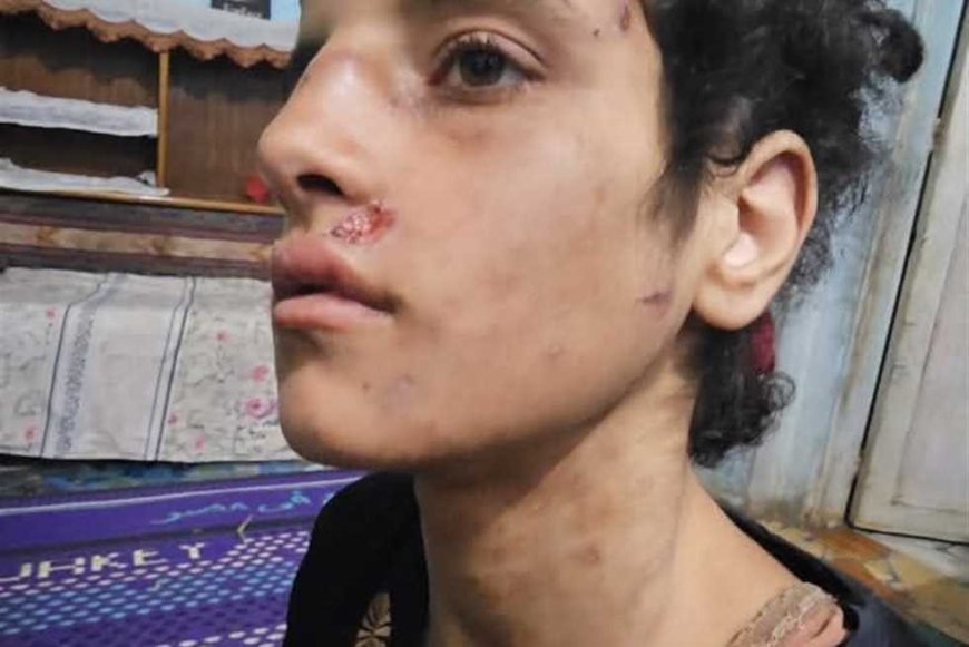 حالتها الصحية متدهورة.. محام يتهم والد طفلة وزوجته بتعذيبها داخل حظيرة مواشي بالمنوفية